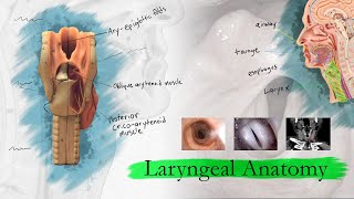 Radiofrequency ablation of the esophagus [upl. by Ayouqat]