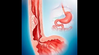 Foregut Development Esophagus amp Stomach – Embryology  Lecturio [upl. by Neelhtak]