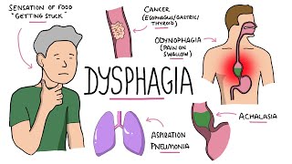 Anatomy of the Esophagus  Dr Ahmed Farid [upl. by Eidaj529]