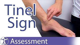 Tinels Sign Ankle⎟Peripheral Nerve Injury [upl. by Wetzel]