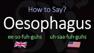 Diseases of the esophagus part 1 by ASM Minds [upl. by Riamo661]